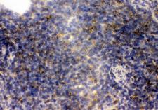 FCER2 / CD23 Antibody - IHC analysis of CD23 using anti-CD23 antibody. CD23 was detected in frozen section of mouse spleen tissues. Heat mediated antigen retrieval was performed in citrate buffer (pH6, epitope retrieval solution) for 20 mins. The tissue section was blocked with 10% goat serum. The tissue section was then incubated with 1µg/ml rabbit anti-CD23 Antibody overnight at 4°C. Biotinylated goat anti-rabbit IgG was used as secondary antibody and incubated for 30 minutes at 37°C. The tissue section was developed using Strepavidin-Biotin-Complex (SABC) with DAB as the chromogen.