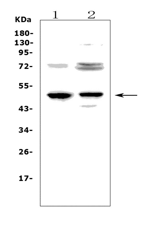 FCER2 / CD23 Antibody - Western blot analysis of CD23 using anti-CD23 antibody. Electrophoresis was performed on a 5-20% SDS-PAGE gel at 70V (Stacking gel) / 90V (Resolving gel) for 2-3 hours. The sample well of each lane was loaded with 50ug of sample under reducing conditions. Lane 1: rat spleen tissue lysates, Lane 2: rat thymus tissue lysates, After Electrophoresis, proteins were transferred to a Nitrocellulose membrane at 150mA for 50-90 minutes. Blocked the membrane with 5% Non-fat Milk/ TBS for 1.5 hour at RT. The membrane was incubated with rabbit anti-CD23 antigen affinity purified polyclonal antibody at 0.5 µg/mL overnight at 4°C, then washed with TBS-0.1% Tween 3 times with 5 minutes each and probed with a goat anti-rabbit IgG-HRP secondary antibody at a dilution of 1:10000 for 1.5 hour at RT. The signal is developed using an Enhanced Chemiluminescent detection (ECL) kit with Tanon 5200 system. A specific band was detected for CD23 at approximately 49KD. The expected band size for CD23 is at 36KD.