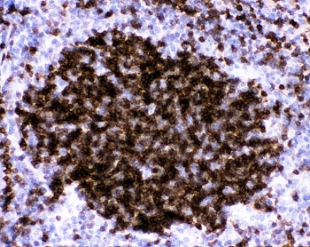 FCER2 / CD23 Antibody - IHC-P: CD23 antibody testing of mouse spleen tissue