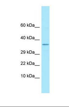 FCER2 / CD23 Antibody - Western blot of Fetal Kidney. Rab6b antibody dilution 1.0 ug/ml.  This image was taken for the unconjugated form of this product. Other forms have not been tested.