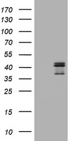 FCER2 / CD23 Antibody - HEK293T cells were transfected with the pCMV6-ENTRY control (Left lane) or pCMV6-ENTRY FCER2 (Right lane) cDNA for 48 hrs and lysed. Equivalent amounts of cell lysates (5 ug per lane) were separated by SDS-PAGE and immunoblotted with anti-FCER2.