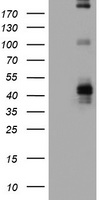 FCER2 / CD23 Antibody - HEK293T cells were transfected with the pCMV6-ENTRY control (Left lane) or pCMV6-ENTRY FCER2 (Right lane) cDNA for 48 hrs and lysed. Equivalent amounts of cell lysates (5 ug per lane) were separated by SDS-PAGE and immunoblotted with anti-FCER2.