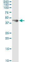 FCER2 / CD23 Antibody - Immunoprecipitation of FCER2 transfected lysate using anti-FCER2 monoclonal antibody and Protein A Magnetic Bead, and immunoblotted with FCER2 rabbit polyclonal antibody.