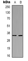 FCER2 / CD23 Antibody - Western blot analysis of CD23 expression in HeLa (A); mouse brain (B) whole cell lysates.