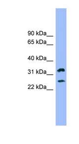 FcERI / Fc Epsilon RI Antibody - FCER1A antibody Western blot of 721_B cell lysate. This image was taken for the unconjugated form of this product. Other forms have not been tested.