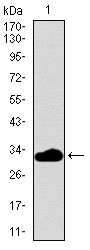 FcERI / Fc Epsilon RI Antibody - Western blot using FCER1A monoclonal antibody against human FCER1A recombinant protein. (Expected MW is 32.5 kDa)