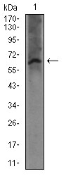 FcERI / Fc Epsilon RI Antibody - Western blot using FCER1A mouse monoclonal antibody against mouse kidney tissue lysate.