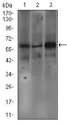FcERI / Fc Epsilon RI Antibody - Western blot using FCER1A mouse monoclonal antibody against SW620 (1), A549 (2), and A431 (3) cell lysate.