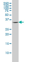 FcERI / Fc Epsilon RI Antibody - FCER1A monoclonal antibody (M01), clone 2C12-3B6 Western Blot analysis of FCER1A expression in A-549.