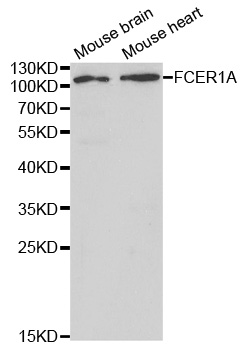 FcERI / Fc Epsilon RI Antibody - Western blot analysis of extracts of various cell lines, using FCER1A antibody at 1:1000 dilution. The secondary antibody used was an HRP Goat Anti-Rabbit IgG (H+L) at 1:10000 dilution. Lysates were loaded 25ug per lane and 3% nonfat dry milk in TBST was used for blocking.