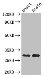 FcERI / Fc Epsilon RI Antibody - Western Blot Positive WB detected in:Mouse heart tissue,Mouse brain tissue All Lanes: FCER1A antibody at 3ug/ml Secondary Goat polyclonal to rabbit IgG at 1/50000 dilution Predicted band size: 30 kDa Observed band size: 30 kDa