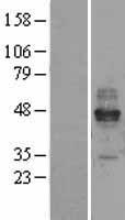 FcERI / Fc Epsilon RI Protein - Western validation with an anti-DDK antibody * L: Control HEK293 lysate R: Over-expression lysate