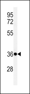 FCGR1A / CD64 Antibody - Western blot of FCGR1A Antibody in NCI-H460 cell line lysates (35 ug/lane). FCGR1A (arrow) was detected using the purified antibody.