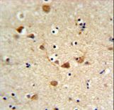 FCGR1A / CD64 Antibody - FCGR1A Antibody IHC of formalin-fixed and paraffin-embedded brain tissue followed by peroxidase-conjugated secondary antibody and DAB staining.