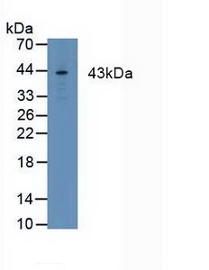 FCGR1A / CD64 Antibody - Western Blot; Sample:Human MCF7 Cells.