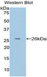 FCGR1A / CD64 Antibody - Western blot of recombinant FCGR1A / CD64.  This image was taken for the unconjugated form of this product. Other forms have not been tested.