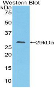 FCGR1A / CD64 Antibody - Western blot of recombinant FCGR1A / CD64.  This image was taken for the unconjugated form of this product. Other forms have not been tested.