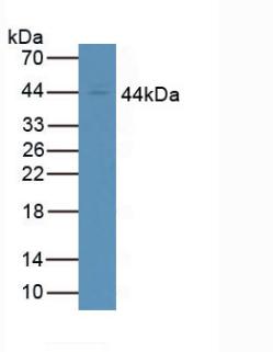 FCGR1A / CD64 Antibody - Western Blot; Sample: Human Jurkat Cells.