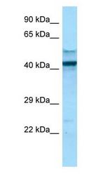 FCGR1A / CD64 Antibody - FCGR1A / CD64 antibody Western Blot of NCI-H226.  This image was taken for the unconjugated form of this product. Other forms have not been tested.