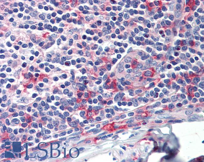 FCGR1A / CD64 Antibody - Anti-FCGR1A / CD64 antibody IHC staining of human tonsil. Immunohistochemistry of formalin-fixed, paraffin-embedded tissue after heat-induced antigen retrieval.