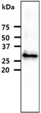 FCGR1A / CD64 Antibody - The recombinant protein (20ug) were resolved by SDS-PAGE, transferred to PVDF membrane and probed with anti-human FCGR1A antibody (1:1000). Proteins were visualized using a goat anti-mouse secondary antibody conjugated to HRP and an ECL detection system.