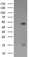 FCGR1A / CD64 Antibody - HEK293T cells were transfected with the pCMV6-ENTRY control (Left lane) or pCMV6-ENTRY FCGR1A (Right lane) cDNA for 48 hrs and lysed. Equivalent amounts of cell lysates (5 ug per lane) were separated by SDS-PAGE and immunoblotted with anti-FCGR1A.