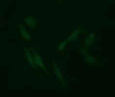 FCGR1A / CD64 Antibody - Immunofluorescent staining of HeLa cells using anti-FCGR1A mouse monoclonal antibody.