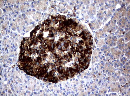 FCGR1A / CD64 Antibody - Immunohistochemical staining of paraffin-embedded Human pancreas tissue using anti-FCGR1A mouse monoclonal antibody.  heat-induced epitope retrieval by 10mM citric buffer, pH6.0, 120C for 3min)