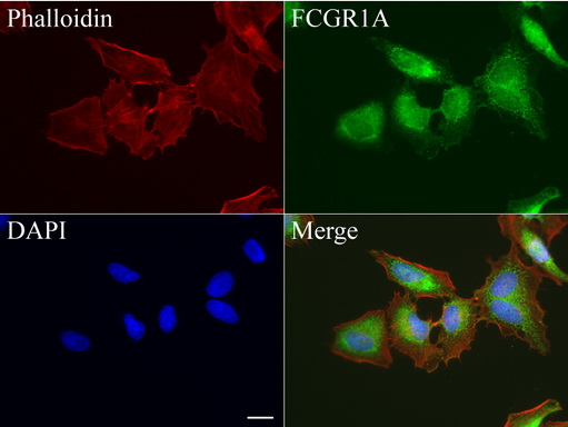 FCGR1A / CD64 Antibody - Immunofluorescent staining of HeLa cells using anti-FCGR1A mouse monoclonal antibody  green, 1:50). Actin filaments were labeled with Alexa Fluor® 594 Phalloidin. (red), and nuclear with DAPI. (blue). Scale bar, 20µm.