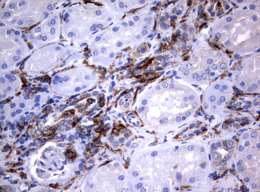 FCGR1A / CD64 Antibody - Immunohistochemical staining of paraffin-embedded Human Kidney tissue using anti-FCGR1A mouse monoclonal antibody.  heat-induced epitope retrieval by 10mM citric buffer, pH6.0, 120C for 3min)