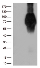 FCGR1A / CD64 Antibody - HEK293T cells were transfected with the pCMV6-ENTRY control. (Left lane) or pCMV6-ENTRY FCGR1A. (Right lane) cDNA for 48 hrs and lysed. Equivalent amounts of cell lysates. (5 ug per lane) were separated by SDS-PAGE and immunoblotted with anti-FCGR1A. (1:2000)