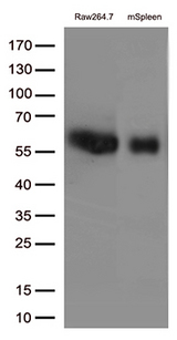 FCGR1A / CD64 Antibody - Western blot analysis of extracts. (35ug) from 1 cell line and 1 tissue lysates by using anti-FCGR1A monoclonal antibody. (1:500)