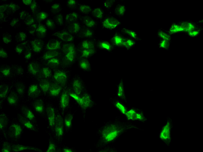 FCGR1A / CD64 Antibody - Immunofluorescence analysis of MCF-7 cells.