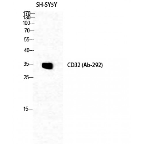 FCGR2 / CD32 Antibody - Western blot of CD32 antibody
