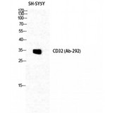 FCGR2 / CD32 Antibody - Western blot of CD32 antibody