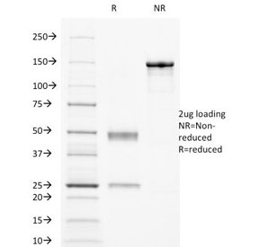 FCGR2 / CD32 Antibody - SDS-PAGE Analysis of Purified, BSA-Free CD32 Antibody (clone 8.7). Confirmation of Integrity and Purity of the Antibody.