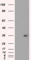 FCGR2 / CD32 Antibody - HEK293T cells were transfected with the pCMV6-ENTRY control (Left lane) or pCMV6-ENTRY FCGR2A (Right lane) cDNA for 48 hrs and lysed. Equivalent amounts of cell lysates (5 ug per lane) were separated by SDS-PAGE and immunoblotted with anti-FCGR2A.