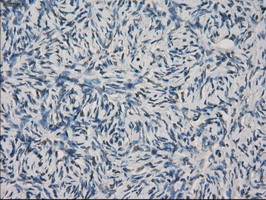 FCGR2 / CD32 Antibody - IHC of paraffin-embedded Ovary tissue using anti-FCGR2A mouse monoclonal antibody. (Dilution 1:50).
