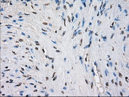 FCGR2 / CD32 Antibody - IHC of paraffin-embedded prostate tissue using anti-FCGR2A mouse monoclonal antibody. (Dilution 1:50).