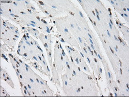 FCGR2 / CD32 Antibody - IHC of paraffin-embedded bladder tissue using anti-FCGR2A mouse monoclonal antibody. (Dilution 1:50).