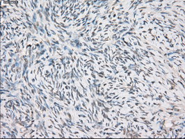 FCGR2 / CD32 Antibody - IHC of paraffin-embedded Ovary tissue using anti-FCGR2A mouse monoclonal antibody. (Dilution 1:50).