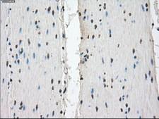 FCGR2 / CD32 Antibody - IHC of paraffin-embedded colon tissue using anti-FCGR2A mouse monoclonal antibody. (Dilution 1:50).