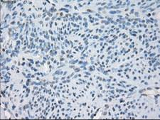 FCGR2 / CD32 Antibody - IHC of paraffin-embedded endometrium tissue using anti-FCGR2A mouse monoclonal antibody. (Dilution 1:50).