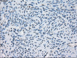 FCGR2 / CD32 Antibody - IHC of paraffin-embedded endometrium tissue using anti-FCGR2A mouse monoclonal antibody. (Dilution 1:50).