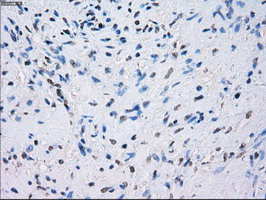 FCGR2 / CD32 Antibody - IHC of paraffin-embedded prostate tissue using anti-FCGR2A mouse monoclonal antibody. (Dilution 1:50).