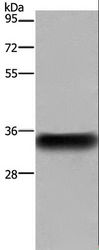 FCGR2 / CD32 Antibody - Western blot analysis of Human placenta tissue, using FCGR2B Polyclonal Antibody at dilution of 1:850.