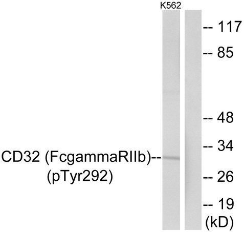 FCGR2 / CD32 Antibody - Western blot analysis of lysates from K562 cells treated with PMA 125ng/ml 30', using CD32 (Phospho-Tyr292) Antibody. The lane on the right is blocked with the phospho peptide.