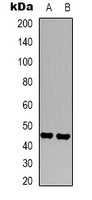 FCGR3A / CD16A Antibody - Western blot analysis of CD16 expression in Jurkat (A); K562 (B) whole cell lysates.