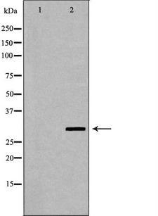 FCGR3A / CD16A Antibody - Western blot analysis of extracts of mouse liver tissue using FCGR3A antibody. The lane on the left is treated with the antigen-specific peptide.