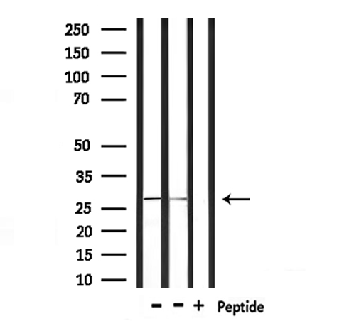 FCGR3A / CD16A Antibody - Western blot analysis of extracts of rat heart and mouse brain tissue using FCGR3A antibody.